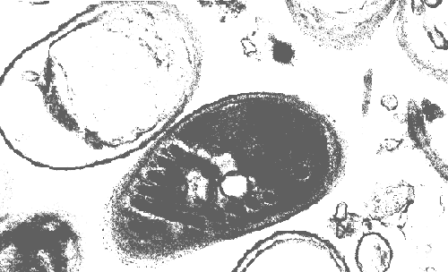 Encephalitozoon intestinalis Encephalitozoon intestinalis